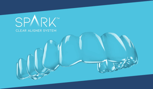 Spark Clear Aligners